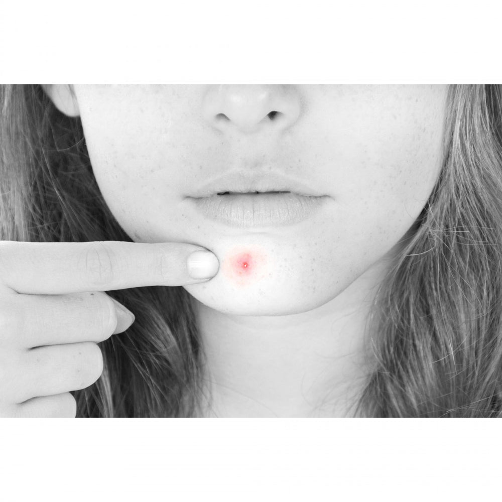 Clear Cream – Alex Cosmetic USA